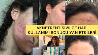 AKNETRENT SİVİLCE TEDAVİ SÜRECİM NELER YAŞADIM YAN ETKİLERİ NE OLDU  AKNE ROACCUTANE SİVİLCE [upl. by Yentiw305]