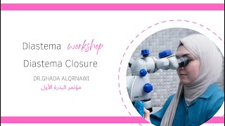 Diastema Closure Workshop  مؤتمر البذرة الأول 2023 [upl. by Layol294]