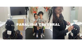 Paralisia Cerebral  desafios e tratamento [upl. by Eryt]