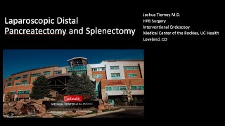 Laparoscopic distal pancreatectomy with splenectomy [upl. by Arada]