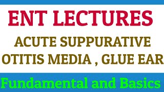 Acute Suppurative Otitis Media  ASOM  GLUE EAR  ENT LECTURES [upl. by Solon]