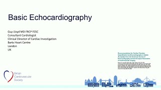 Basic Echocardiography Review echocardiogram [upl. by Alyek]