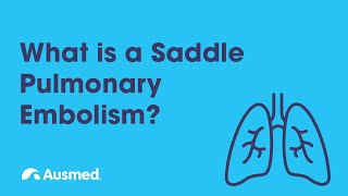 What is a Saddle Pulmonary Embolism PE  Ausmed Explains [upl. by Renate6]