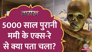 5000 साल पुरानी Mummy के एक्सरे से क्या पता चला  Otzi the Iceman  Tarikh E555 [upl. by Horowitz]