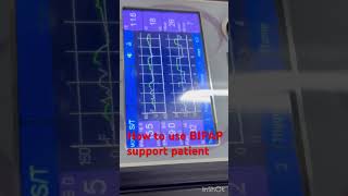 How to use bipap machine  BIPAP support icu patient  BIPAP setup icu patient  bipap shorts [upl. by Dalia]