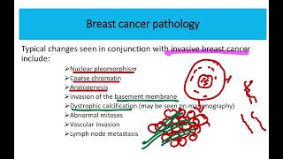 Breast cancer pathology MRCS question solve CRACK MRCS [upl. by Adnalay260]