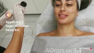 Nomelan Fenol KH Peeling  ASTOMED klinikutrustning [upl. by Enaoj]