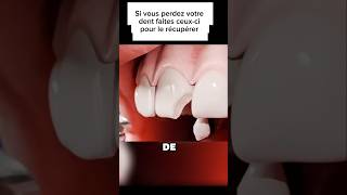 Processus de réparation dune dent shortvideo sciencepopulaire shorts dentist shortviral [upl. by Lennon]