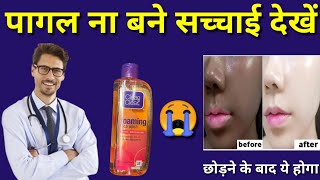 Clean Clear Face Wash Review in Hindi 2023 Clean And Clear Foaming Face Wash Uses in Hindi [upl. by Eidlog]