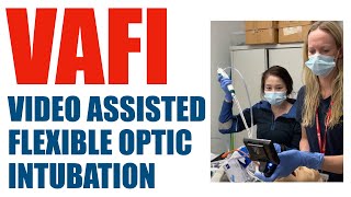 Video Assisted Flexibleoptic Intubation [upl. by Aicineohp]