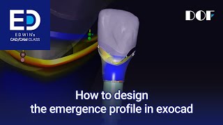 How to design the emergence profile in exocad [upl. by Anaitsirhc]