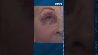 Pensacola woman injured during encounter while waving Kamala Harris sign [upl. by Ganny]