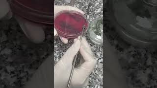 Sputum Culture Diagnosing Respiratory Infections  Lab Testing Guide labinsight lab shortvideo [upl. by Selway]