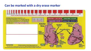 EKG Concepts  RCAT Window  Interpreting EKGs [upl. by Gronseth986]