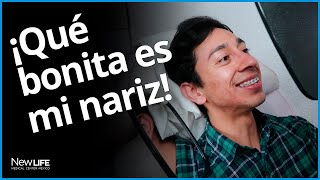 ¿Cómo me arreglo la nariz ¡No me gusta  Rinomodelación Permanente Sin Cirugía New Life Center [upl. by Ainig]