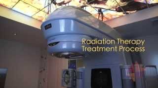 Targeting Cancer  Radiation Therapy Treatment Process [upl. by Eerb]