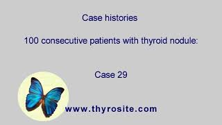 100 consecutive patients with nodular goiter  case 29 [upl. by Rozella]