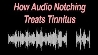 How Audio Notching Treats Tinnitus [upl. by Enilamme988]