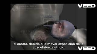 Patología del Sistema Osteoarticular  Parte 6 Displasia de Cadera en Caninos CDD [upl. by Eirojam]