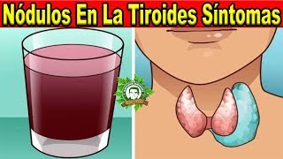 Nódulos En La Tiroides Síntomas y Tratamiento Natural Prueba Este Jugo y Bébelo De Esta Forma [upl. by True]