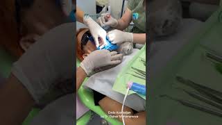 Real world clinical application of rubber dam with Medesy instruments [upl. by Einama]