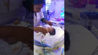 Nasogastric NGTube Insertion in newborn baby Orogastric OGtube [upl. by Zilada]