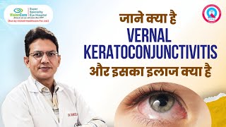 क्या है Vernal Keratoconjunctivitis और इसका इलाज क्या है  VisionCare Super Specialty Eye Hospital [upl. by Maffei]