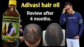 Original Adivasi oil honest review after 4 monthsये सच कोई नहीं बताएगा [upl. by Yrrem]