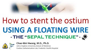 Floating Wire Stenting of AortoOstial Lesions quotSepal Techniquequot [upl. by Ynottirb535]