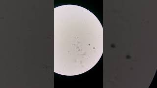 Fungi and Bacteria vs Distilled water laboratory microscope mls bacteria cls lab science [upl. by Atnicaj861]