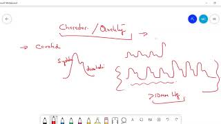 Types of PulsePulsus Paradoxus Pulsus Alternans Anacrotic Waterhammer pulse [upl. by Errehs]