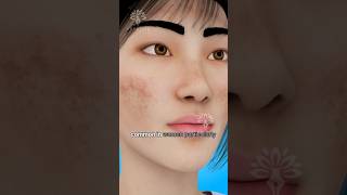 Melasma Why Do These Dark Spots Appear on Your Skin shorts darkspots  Creativelearning3d [upl. by Mariam]