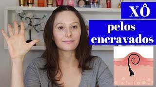 Como ACABAR e PREVENIR os PELOS ENCRAVADOS [upl. by Langham683]