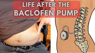 From uncontrollable spasms to relaxed limbs  Life before and after a Baclofen Pump [upl. by Damahom]