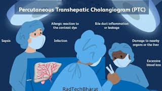 Percutaneous transhepatic cholangiography PTC [upl. by Ymassej]