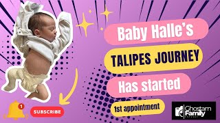 BABY HALLE’S TALIPES JOURNEY pt1 [upl. by Victorie]