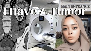 Finding Out I Have A Tumor In My 20s  LipomaSarcoma Ultrasound  CT Scan Reports [upl. by Elma]