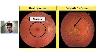 The macula A users guide Alasdair Warwick [upl. by Elinor]