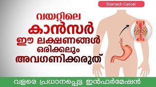 വയറ്റിലെ കാൻസർ ഈ 4 ലക്ഷണങ്ങൾ ഒരിക്കലും അവഗണിക്കരുത്  വളരെ പ്രധാനപ്പെട്ട ഇൻഫർമേഷൻ  Stomach cancer [upl. by Deys]