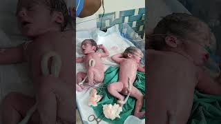 Twins baby after birth cute cutebaby [upl. by Norvil]