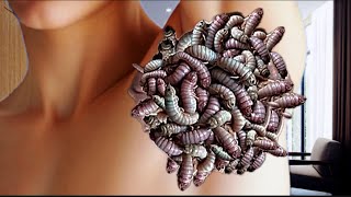 animation of armpit treatment using the technique ASMR 2D reptile removal ASMR [upl. by Aivuy]