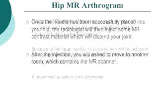 Your Radiologist Explains MR Arthrography of the Hip [upl. by Nalat]