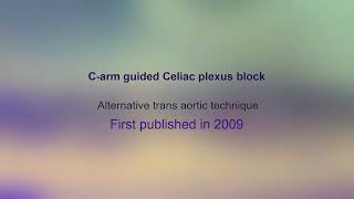 Celiac Plexus Block  Carm Guided Celiac Plexus Block  Transaortic Celiac Plexus Block [upl. by Nawrocki]