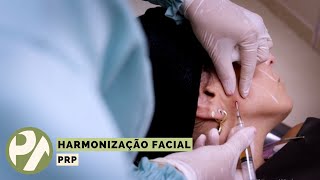 Harmonização Facial  PRP  Programa Pedro Alcântara  17032022 [upl. by Zerlina]