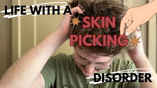 Skin Picking Disorders  The Shame and Stigma That Keeps Us Picking [upl. by Veal140]