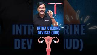 Know about Intra Uterine Device IUD  Ideal Contraceptive Device foryou neetpreparation iud [upl. by Claudette]