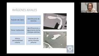 Webinar Histerosalpingografía [upl. by Doretta]