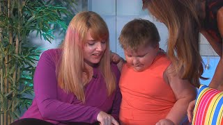 What are Treatment Options for PraderWilli Syndrome [upl. by Cartie]