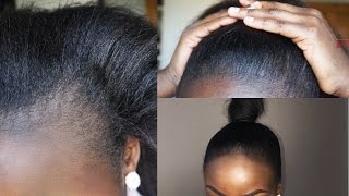 HOW TO THICKEN AND COVER UP BALD EDGES  HIGH BUN TUTORIAL [upl. by Nagram623]