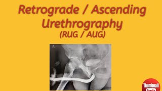 Retrograde  Ascending Urethrography Procedures preparation guide [upl. by Jenkins]